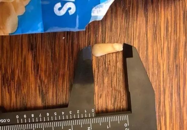 【新焦点】惊！事发平罗！威化饼干中吃出一颗牙齿！河北厂商道歉并赔偿2000元