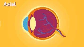 古代人有近视怎么办,古代人近视了该怎么办