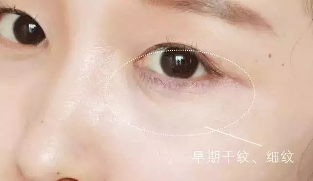 25岁必须用眼霜了吗,25岁之后适合用什么眼霜