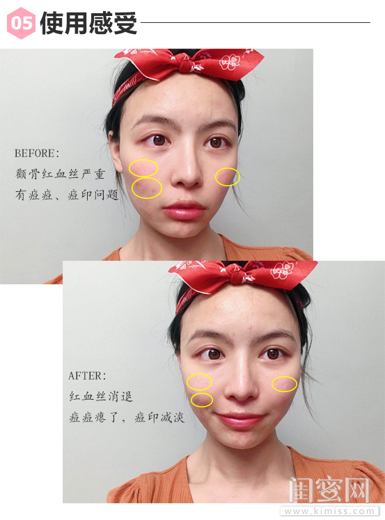 胶原蛋白面膜可复美测评,可复美类胶原蛋白面膜测评