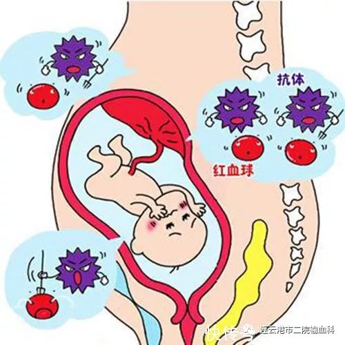 吓坏了的婴儿,b型血和o型血的宝宝会溶血吗
