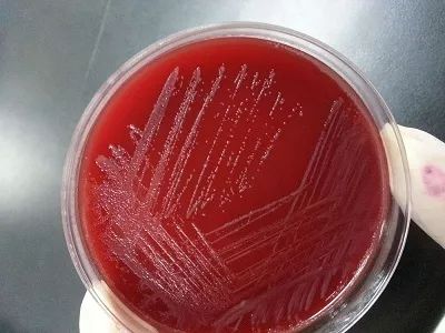 阴道炎老是复发,别再怪老公了!妇产科医生说出大实话!