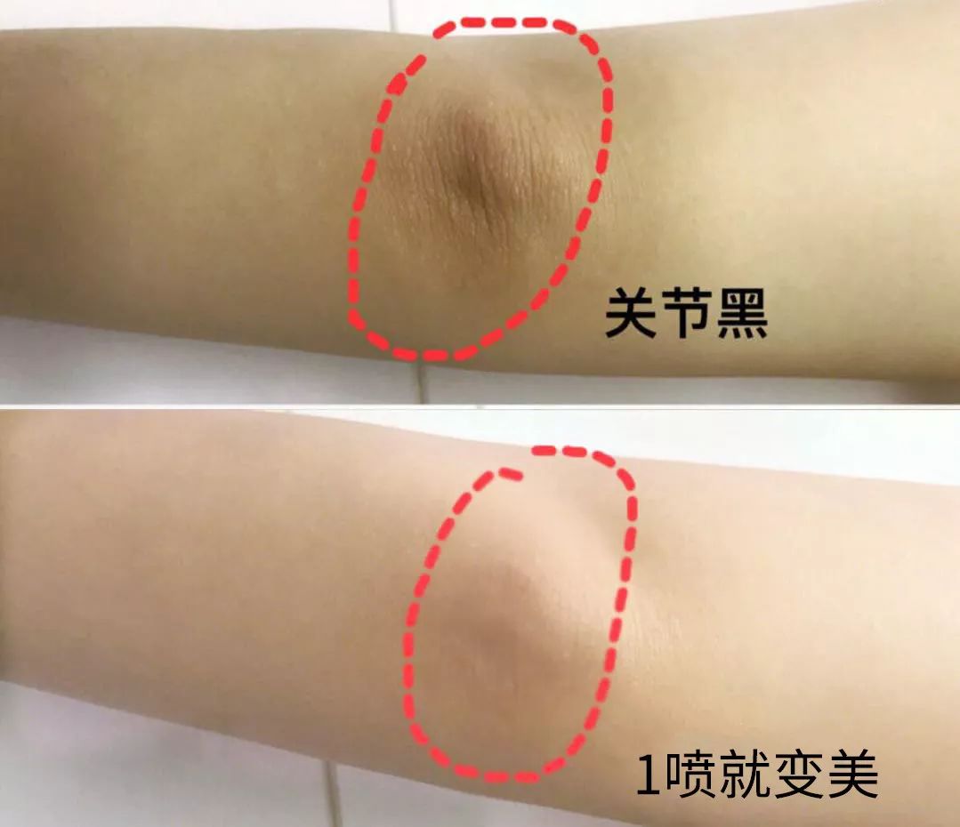 这才是夏天的光腿神器,可以遮腿毛的光腿神器