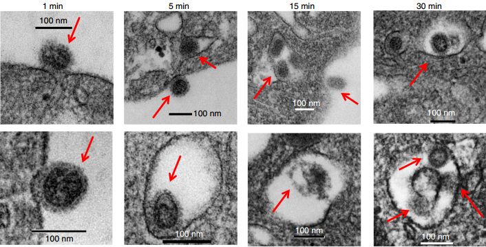 《自然》子刊：“吃货”血小板！科学家发现血小板能吞噬血液中的流感病毒，促进NET释放，或为流感增加心梗风险原因丨科学大发现