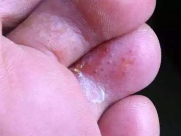 比普通拖鞋好穿100倍！踩在云朵上一样舒服，好穿到爆！永不臭脚！网友：想丢掉家里所有其它拖鞋！