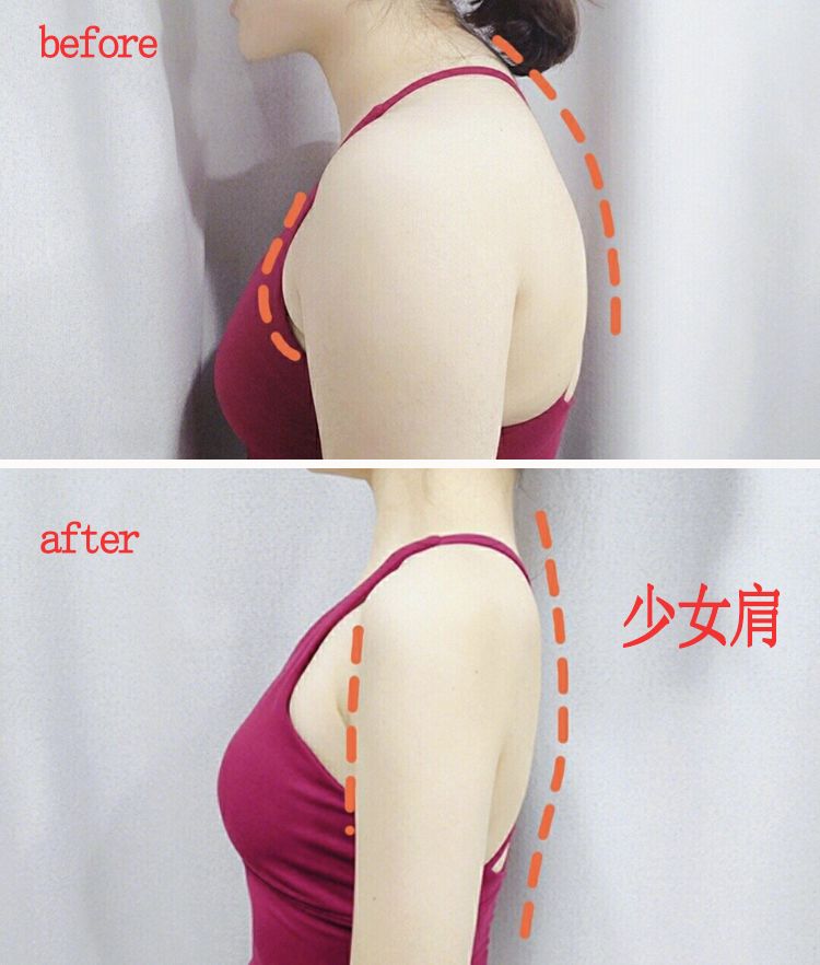 改善含胸驼背的最有效方法10分钟,改善含胸驼背的最有效方法完整版