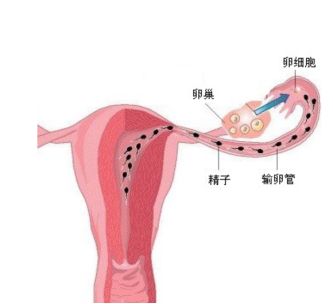 如果有排卵障碍,会影响受孕吗?