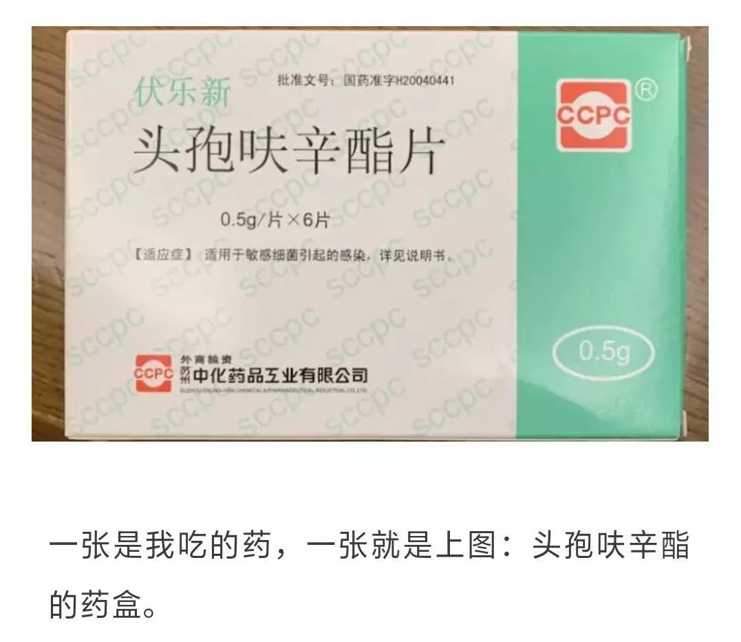 吃了一颗头孢会怎样,头孢吃了24粒医生开错