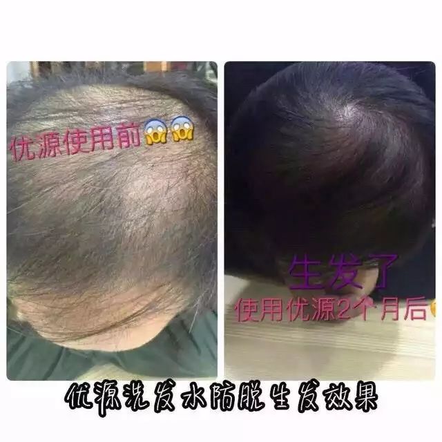 头皮生姜精华修护洗发水,一瓶洗护一体的原浆洗发水