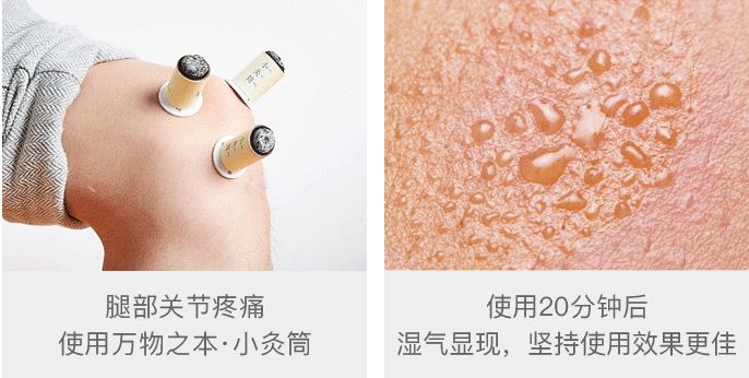 艾灸哪个穴位祛湿效果最好,艾灸贴肚脐祛湿有效果吗