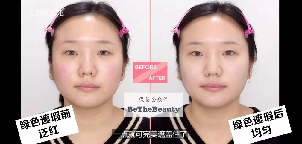 灰头土脸怎么改善,灰头土脸怎么预防