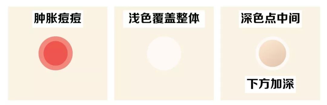 灰头土脸怎么改善,灰头土脸怎么预防