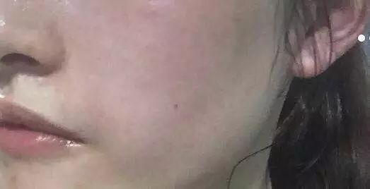 关于你需要知道的事,关于黑眼圈你需要知道的