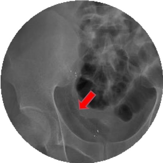 鐢熷懡鎺ュ姏鍣ㄥ畼绉绘鎴愬姛,鐢熷懡璧涜窇鎵嬫湳