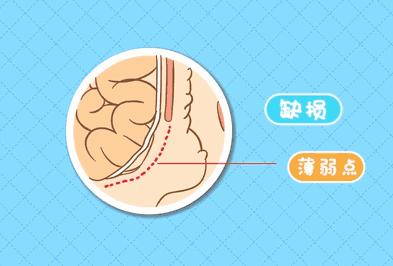 勿以病小而不医勿以病大而自弃,勿以小而不为
