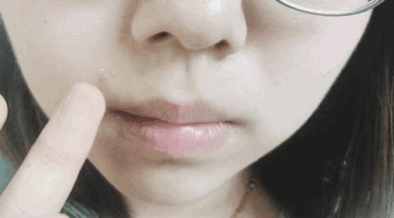 补水保湿晒后修复消炎杀菌,芦荟胶舒缓保湿凝胶儿童可以用吗