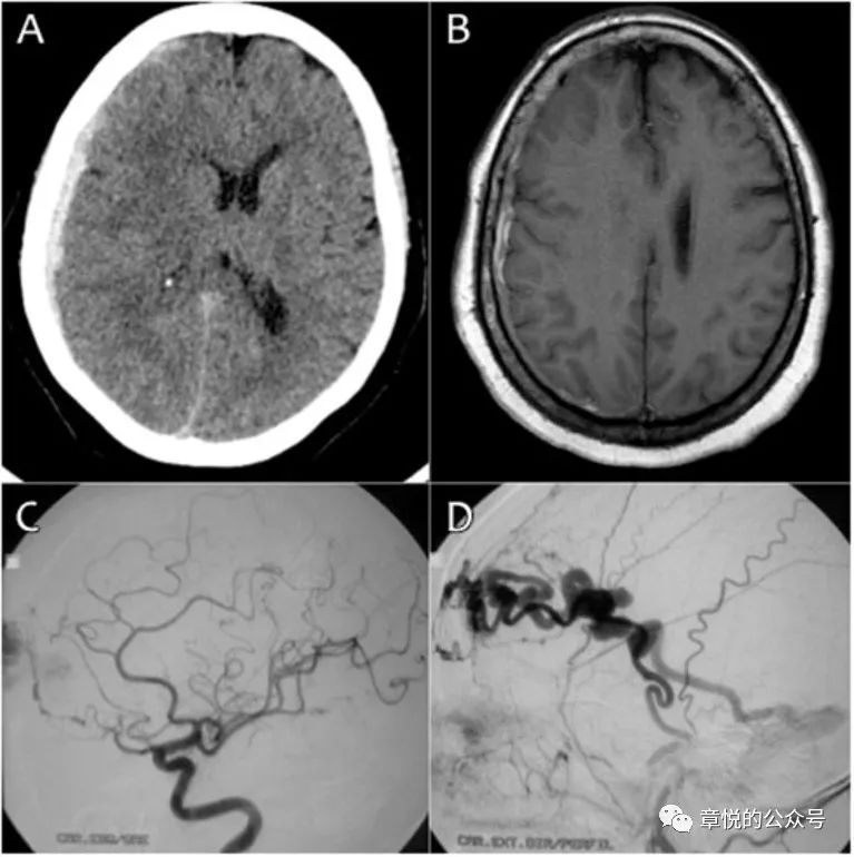 「章悦故事汇」华山“一针灵”