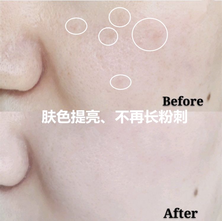 维c美白提亮推荐,抗皱维c