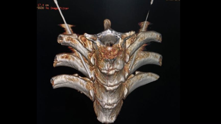 大伯夏季穿两件羽绒服,60岁大爷夏天穿两件羽绒服