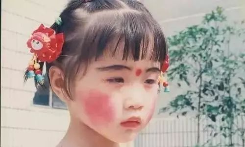 脸上的红血丝怎么处理,脸上的红血丝怎么解决