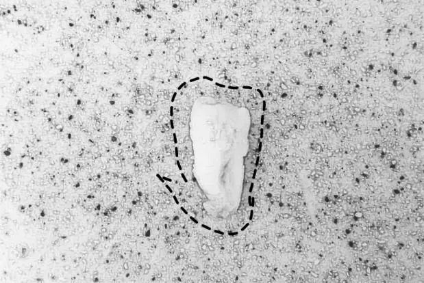 这颗智齿我不要了，爱谁谁