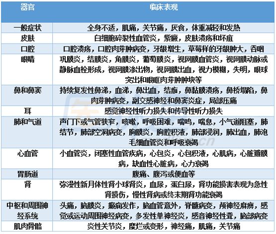 肉芽肿性多血管炎的诊疗要点一览