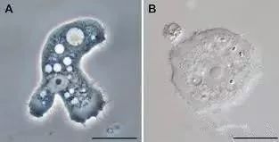 经常戴隐形眼镜真的不好吗,经常戴隐形眼镜有什么不好