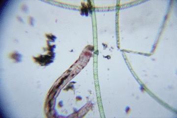 显微镜看到的藻类微生物形态图,藻类浮游生物