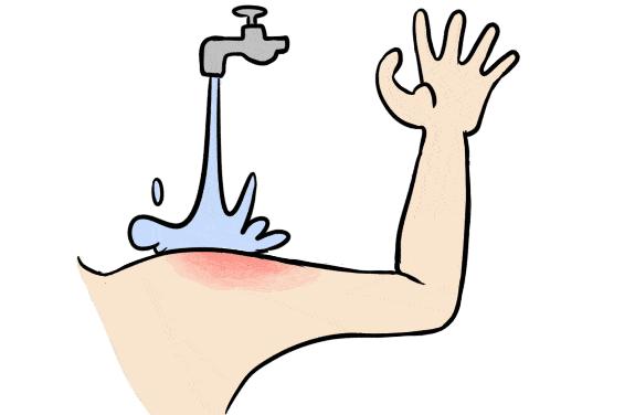 被艾滋病人咬一口会被感染吗,被艾滋病患者咬一口能感染吗