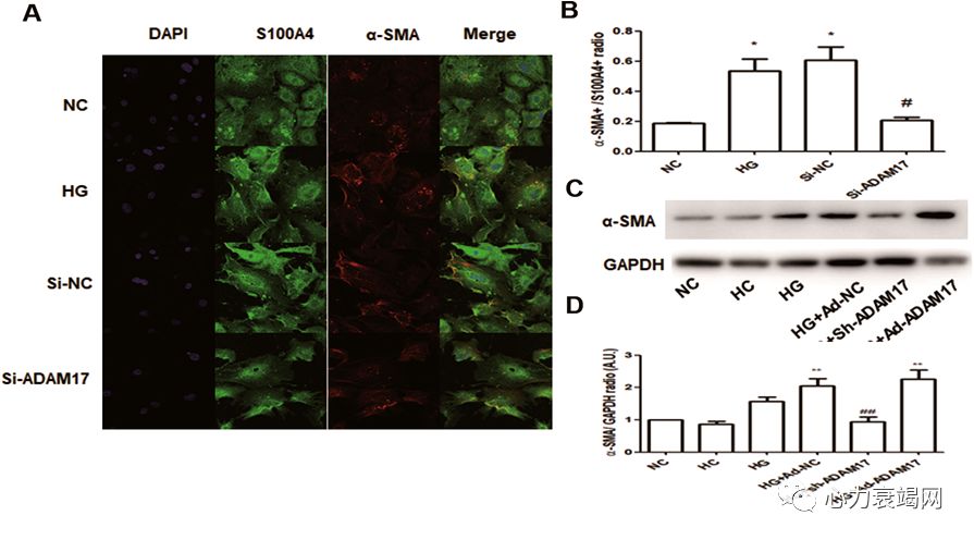 「2019CIHFC」张运教授:ADAM17—糖尿病性心肌病干预的新靶点