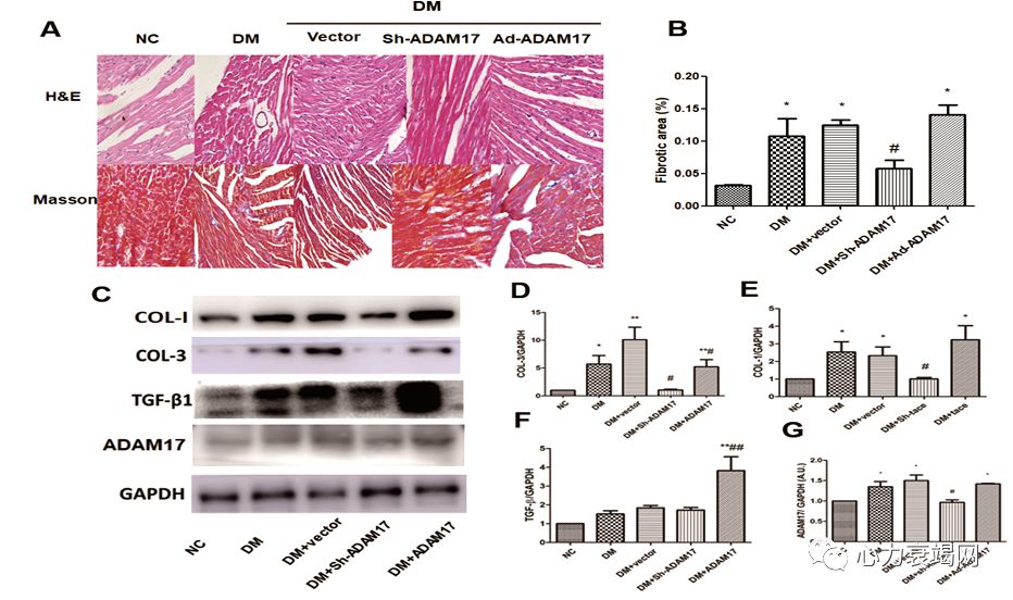 「2019CIHFC」张运教授:ADAM17—糖尿病性心肌病干预的新靶点