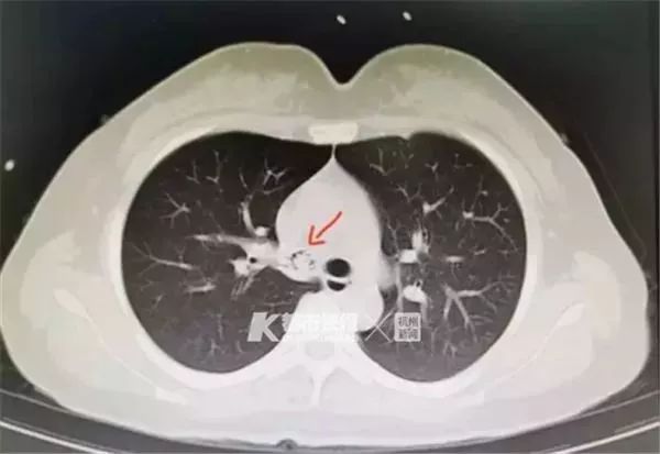 造成虾生病的原因,为什么虾会突然发病