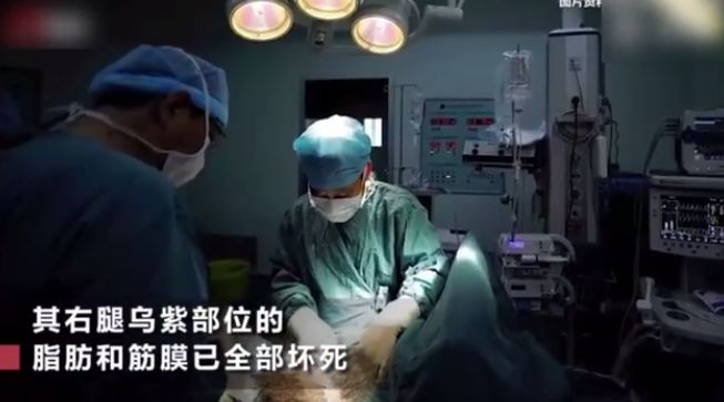 小孩被蚊子咬了反复抠破了怎么办,4岁小孩被蚊子咬鼓大包很硬