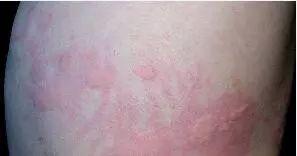 露肉季节快到了身上还是肥嘟嘟的,即使到了露肉的季节也不能松懈