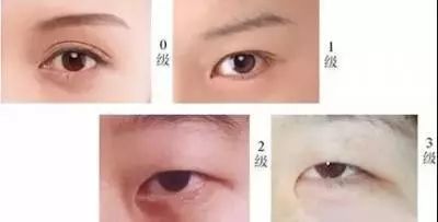 一双眼睛会拯救一张脸吗,一双眼睛是否能拯救一张脸