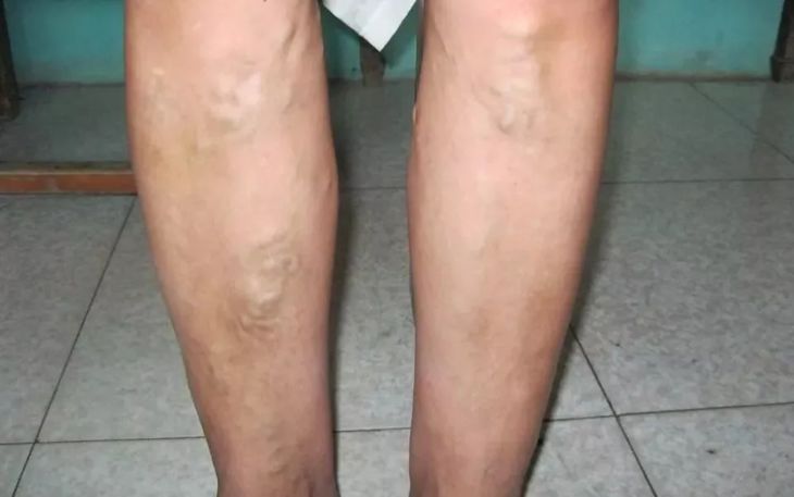 治疗肩颈痛的神器,好的缓解肩颈疼痛产品