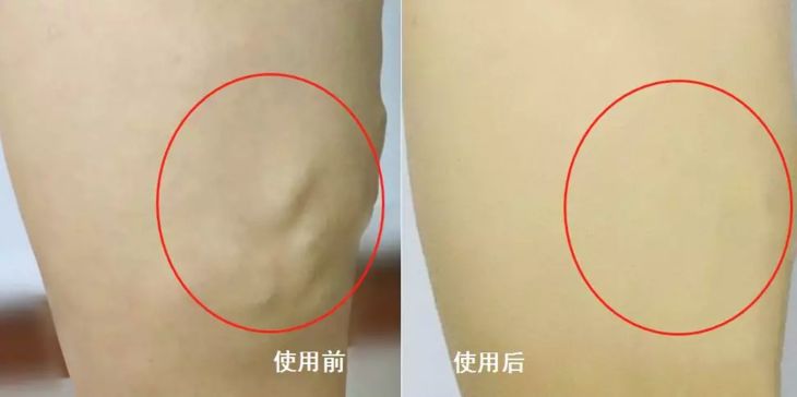 治疗肩颈痛的神器,好的缓解肩颈疼痛产品