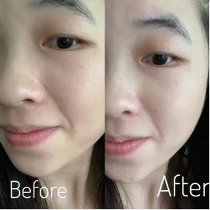 雅萌美容仪器max二代排行榜第一名,雅萌哪款美容仪性价比高