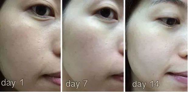 懒人美白黑科技,黑科技一秒变白的神器