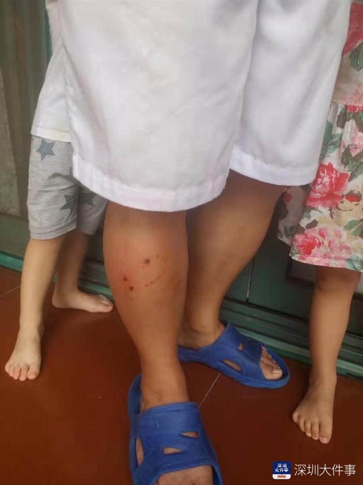 在小区被流浪猫抓伤,男子恶意踩猫被猫抓伤