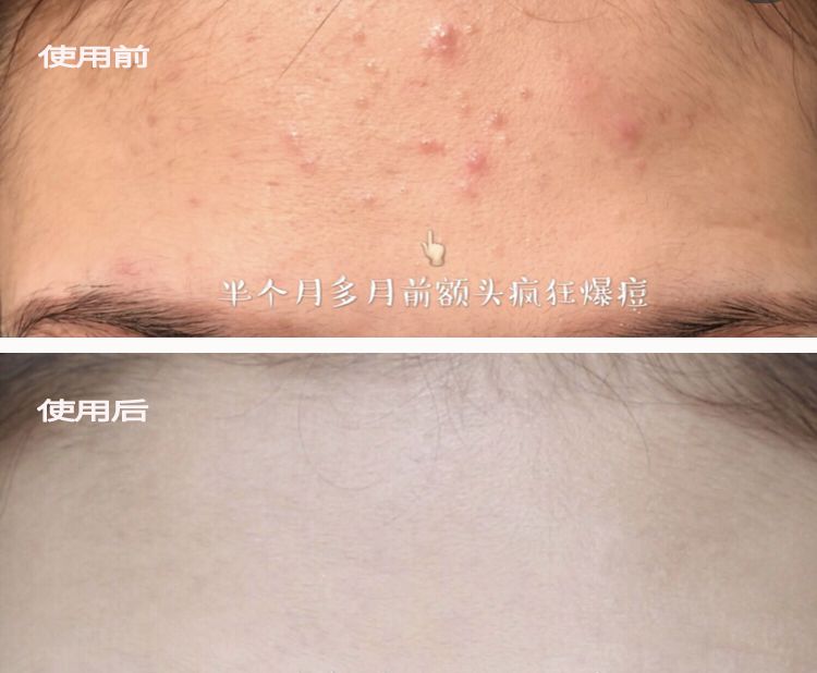 脸上搓出3斤泥！难怪又黄又暗又黑头！10秒给脸蛋“剥壳”，厉害