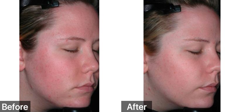 张雪迎白发王妃哭戏,张雪迎白发王妃插曲心锁