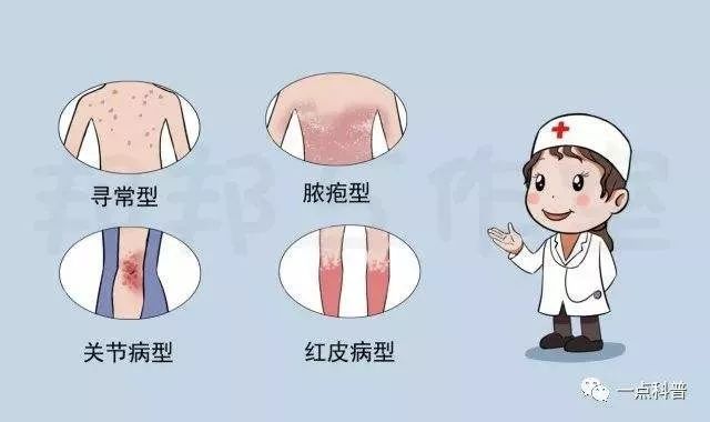 银屑病患者诊疗中注意事项,银屑病怎么治疗好的心得