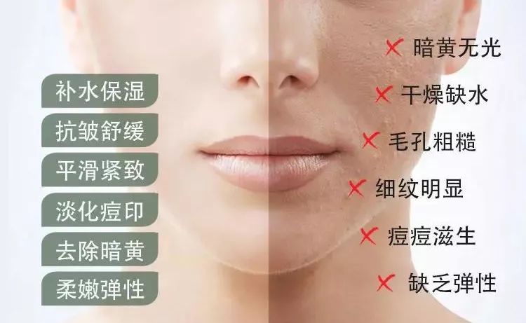 芦荟胶补水保湿提亮肤色晒后修复,祛痘晒后修复保湿补水芦荟胶