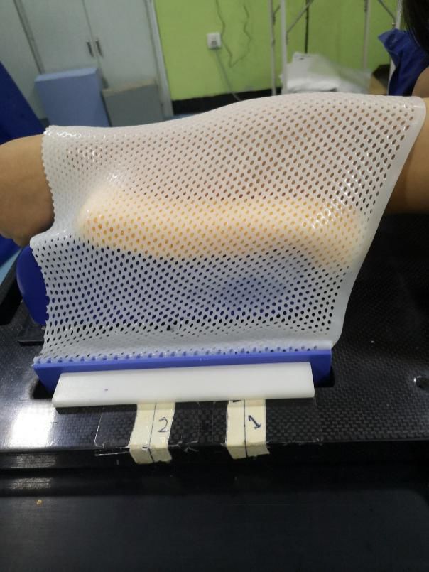 患者初次放疗注意事项,放疗体位固定跟ct模拟需要多久