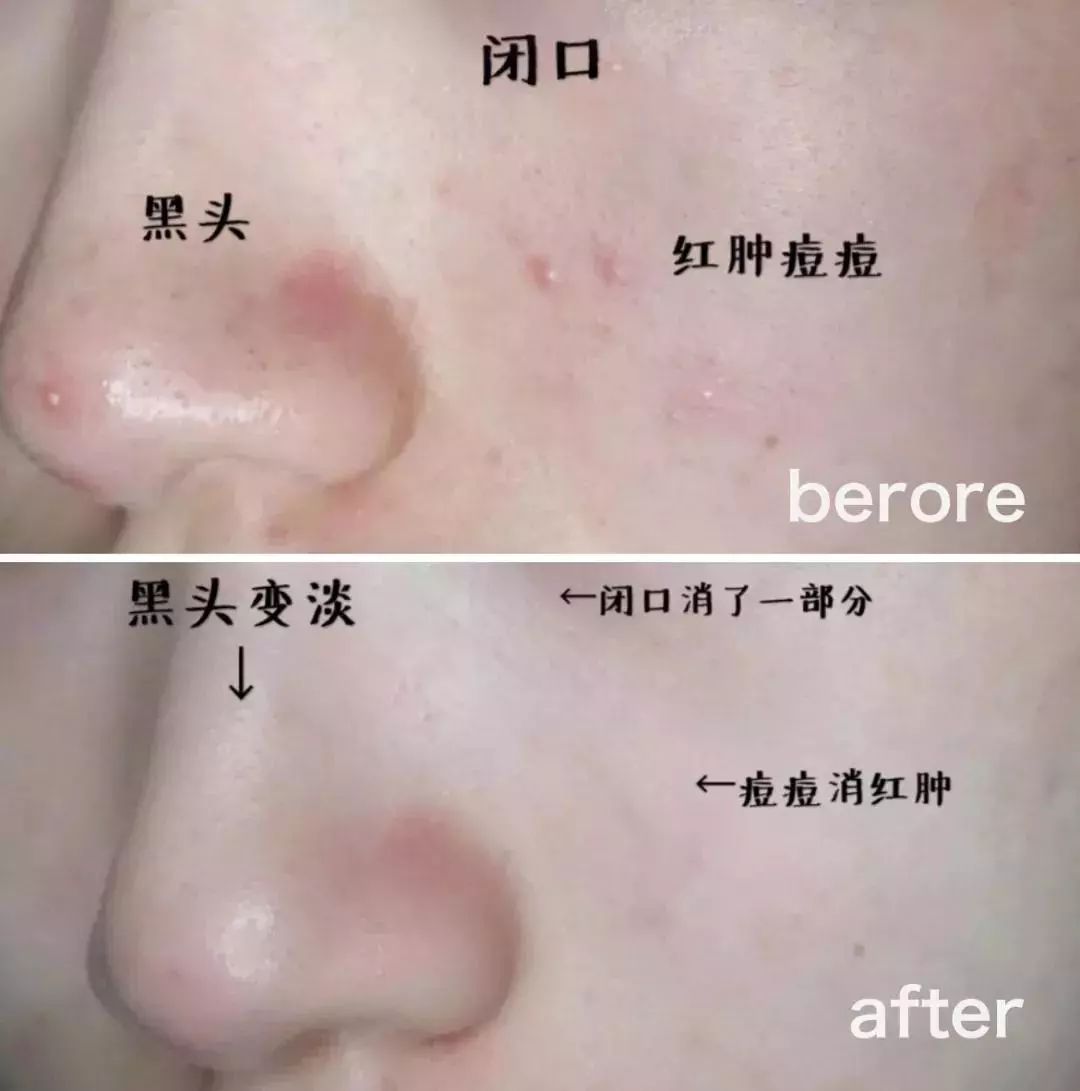 新西兰草本植物精华,新西兰精华液护肤品