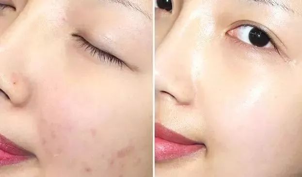 新西兰草本植物精华,新西兰精华液护肤品