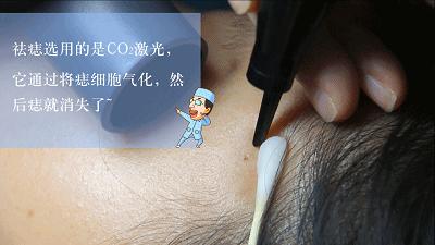 突然长痣是不是出了什么问题知乎,女人左手背突然长痣代表什么