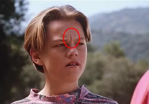 法令纹又黑又长,法令纹又深又长好吗