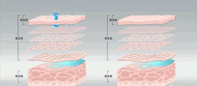 眉间纹和法令纹除皱针能去掉吗,嘴角纹法令纹抬头纹国货推荐